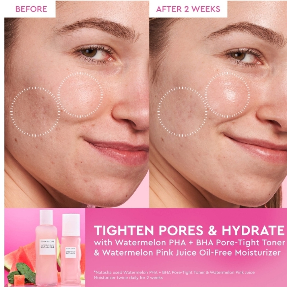Glow Recipe Watermelon Glow Pink Juice Moisturizer, 50ml, NIB - Picture 3 of 8